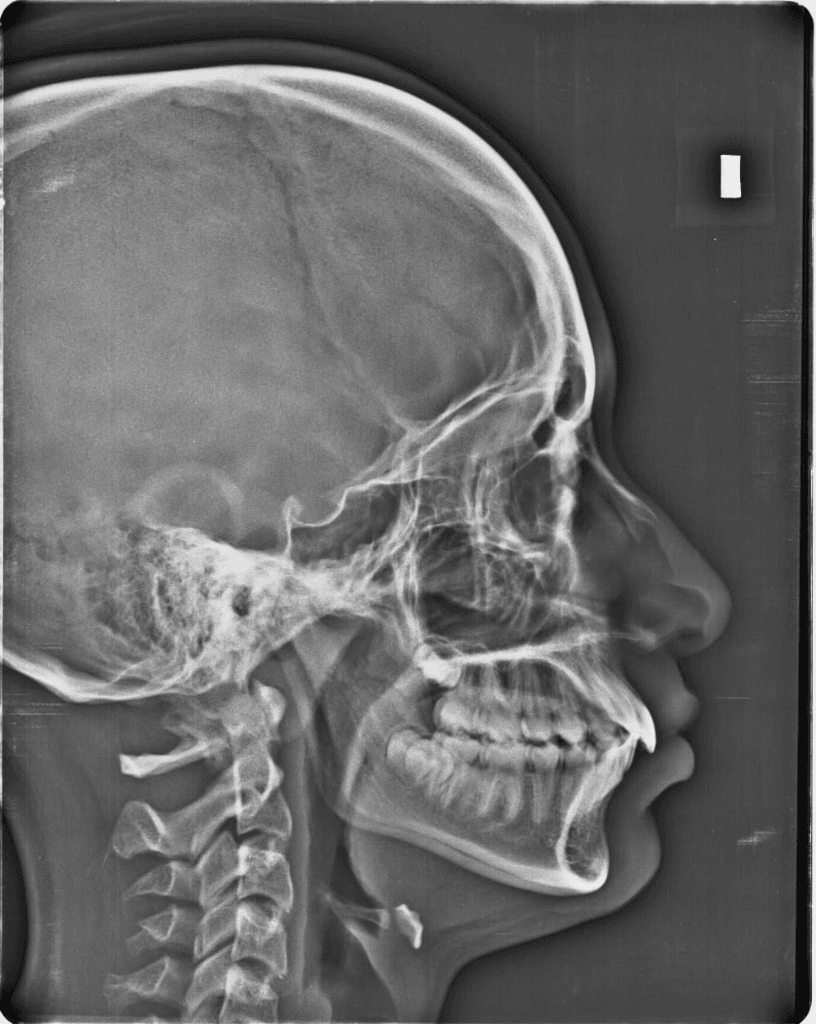 2D Cephalometric