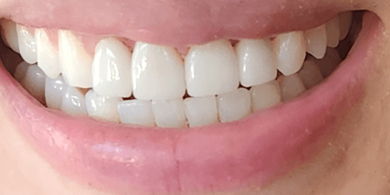 Intra/Extra-Oral Photographs
