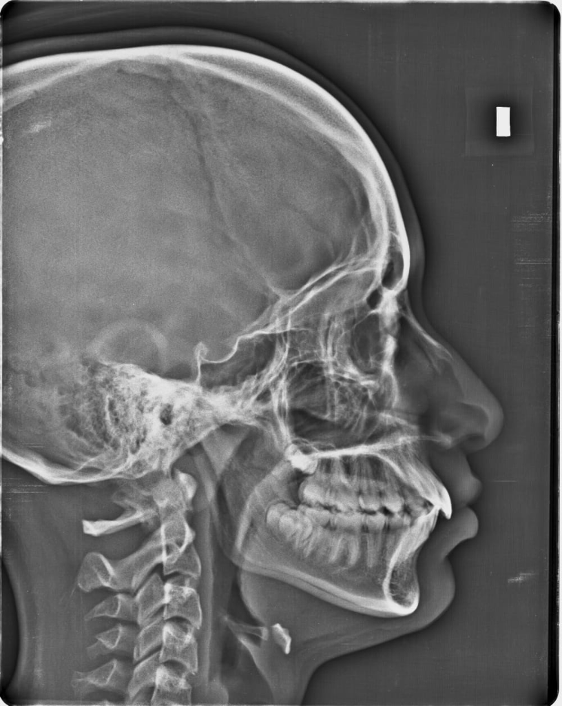 2D Cephalometric