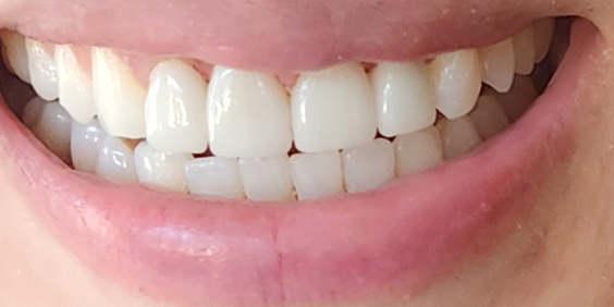 Intra/Extra-Oral Photographs